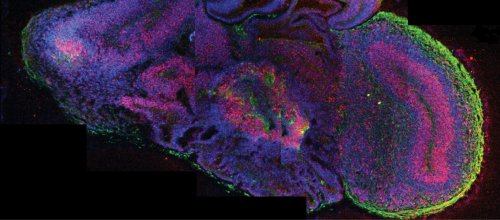 Querschnitt eines vollständigen zerebralen Organoids © IMBA / Madeline Lancaster