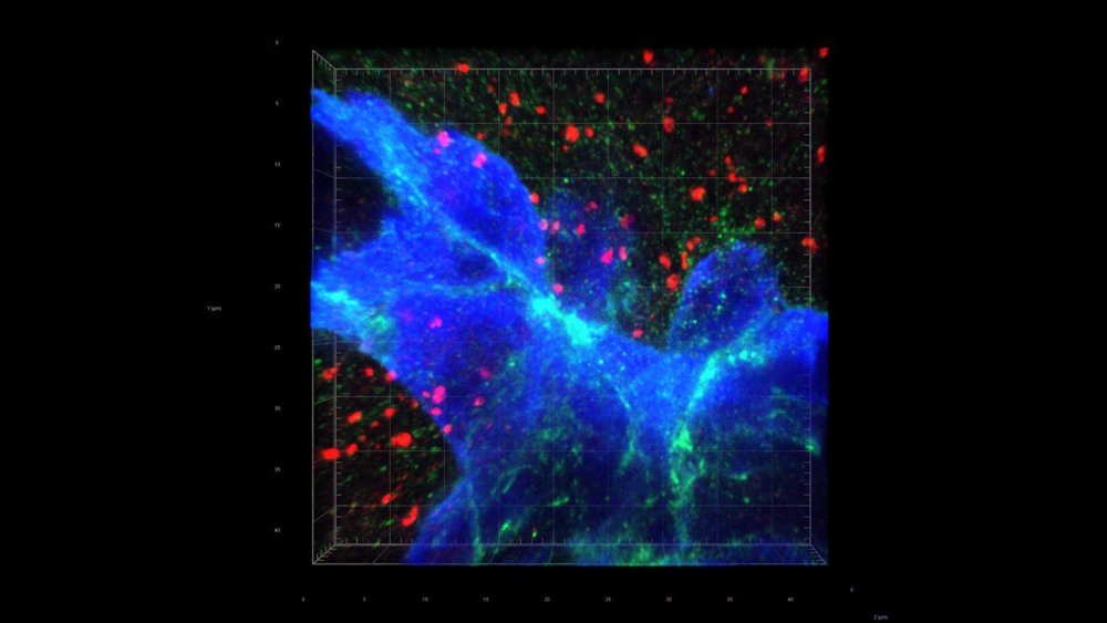 Breast cancer cells (blue) associate with glutamate-secreting neurons (red) to stimulate NMDA receptor-mediated signaling (green) of tumor growth (STED super-resolution microscopy). 